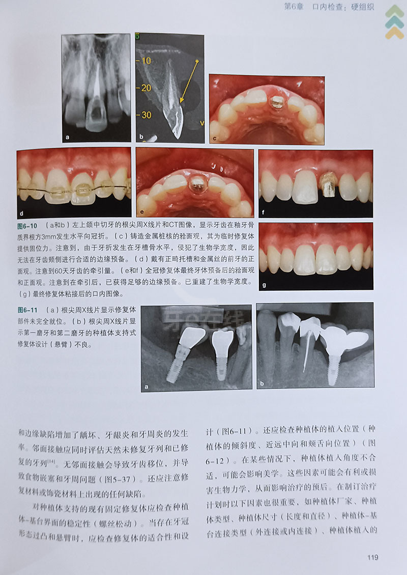 牙齒修復(fù)前沿技術(shù)觀(guān)點(diǎn)論述