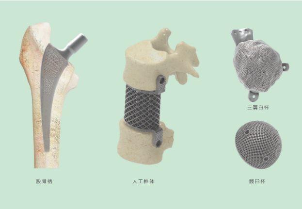 三維打印髖關(guān)節(jié)技術(shù)新動(dòng)態(tài)，重塑生活的科技魔法奇跡